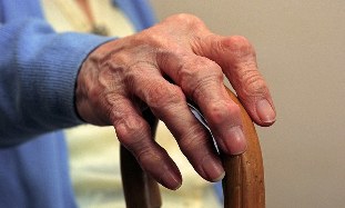 Artrīts un pirkstu artroze vecāka gadagājuma cilvēkam