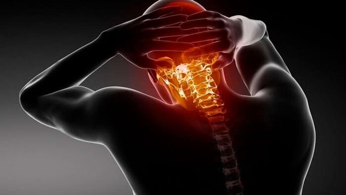 galvassāpes ar dzemdes kakla osteohondrozi