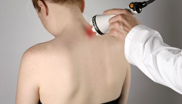 Lāzerterapija dzemdes kakla osteohondrozes ārstēšanai