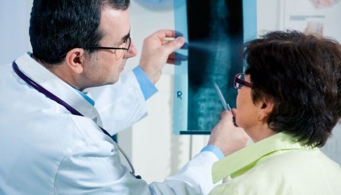 rentgenogrāfija kā metode dzemdes kakla osteohondrozes diagnosticēšanai